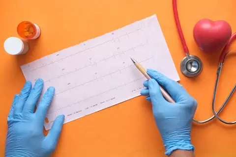 Eletrocardiograma